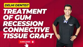 Whats the BEST Gum Recession Treatment in India [upl. by Middendorf]