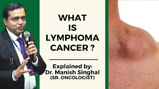 What is Lymphoma Cancer   Symptoms amp Treatment  Dr Manish Singhal Sr Medical Oncologist [upl. by Russel]