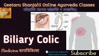 Biliary colic by Geetaru Kayachikitsa Shalytantra Gitaru BAMS Ayurveda Surgery Medicine Bams [upl. by Eyllom388]