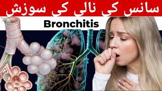 Bronchitis in HindiUrdu Causes Symptoms Bronchitis Treatment [upl. by Anomas]