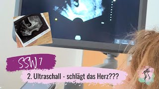 SSW 7  2Ultraschall  Schlägt das Herz 🥹  Mädchen oder Junge Ramzi Methode [upl. by Nurav]