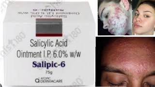 Salipic 6 Ointment Cream Salicylic Acid Ointment IP 60 ww [upl. by Goddard]