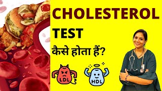 Cholesterol Test in Hindi  Cholesterol Test Kaise Kiya Jata Hai [upl. by Ilera]