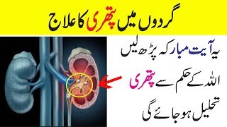 Gurdon ki pathri ka rohani ilaj  Verse to remove kidney stone  Urdu Wazifa [upl. by Enneirdna901]