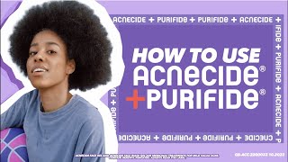 Get started with Acnecide benzoyl peroxide spot treatment What you need to know [upl. by Sternlight]