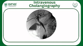 Intravenous Cholangiography What is a Cholangiography used forWhat is a Cholangiography Procedure [upl. by Schaeffer199]