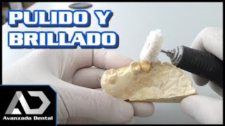 Corona Provisional De Acrilico  Técnica Llave De Silicona Matriz Parte 2 [upl. by Lenhard]