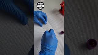 🩸¿Como Hacer un FROTIS SANGUÍNEO Extendido de Sangre Periférica 🔬Tutorial Laboratorio Clínico P2 [upl. by Aimej]