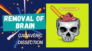 Removal of Brain  A cadaveric dissection  Anatomy [upl. by Crompton]