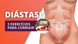 COMO CORRIGIR A DIÁSTASE com 3 EXERCÍCIOS em casa  Método Pilates [upl. by Filmer365]