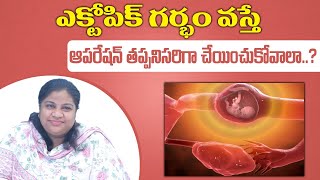 Ectopic pregnancy without Operationక్టోపిక్ ప్రెగ్నెన్సీ ఆపరేషన్ లేకుండాIVY WOMEN amp FERTILITY [upl. by Gib]