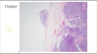 Artifacts in Histopathology and Cytopathology [upl. by Radu]