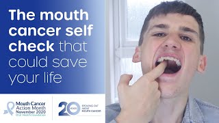 How to do a mouth cancer check at home [upl. by O'Donnell]