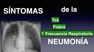 ¿Cuáles son los SÍNTOMAS de la NEUMONÍA TÍPICA vs ATÍPICA [upl. by Herby]