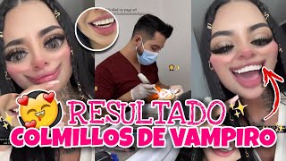 😱así le quedaron LOS COLMILLOS 😱😳 VAMPIRO PARTE 2 SOFI MUÑOZ [upl. by Kiefer]