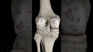 Knee joint 3d representation anatomy medicalimaging radiology medicaltest ctscan [upl. by Alyn]