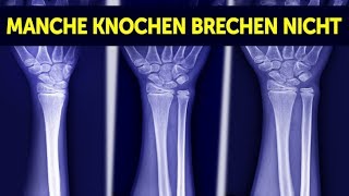 12 extrem seltene Eigenschaften die du wahrscheinlich nicht hast [upl. by Ahsenet]