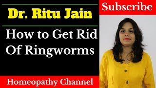 How To Get Rid of Ringworms  Ringworm Treatment  दाद का इलाज [upl. by Brubaker534]