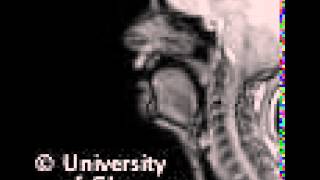 MRI voiceless alveolopalatal fricative [upl. by Alliuqal809]