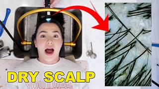 Trying The Viral Scalp Spa  Merrell Twins [upl. by Web]