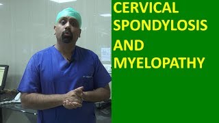 What is Cervical spondylosis Cervical Spinal cord compression and Myelopathy मानेचा संधिवात [upl. by Mikkel]