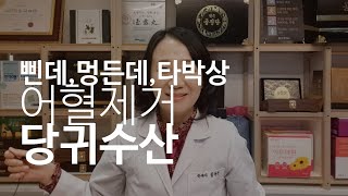 Ep105삔데멍든데타박상에 당귀수산어혈제거교통사고후성형후 강일동 순수한약국꿈꾸는 한약사 김경순 [upl. by Tiduj]