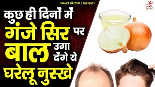 कुछ ही दिनों में खाली जगह में बाल कैसे उगाएं  Ganjepan Ko Door Karne Ke Liye Kya Kare  Hair Care [upl. by Ennayt]