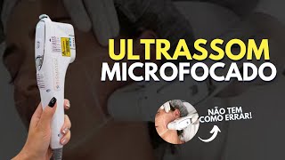 ULTRASSOM MICROFOCADO  COMO É FEITA A APLICAÇÃO [upl. by Nerua]