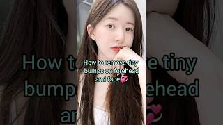 How To Remove Tiny Bumps Pimples On Face And Forehead💞💞diy ytshortsshorts [upl. by Narbig302]