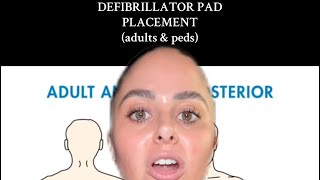 DEFIBRILLATOR PAD PLACEMENT adults and peds [upl. by Virgilio457]