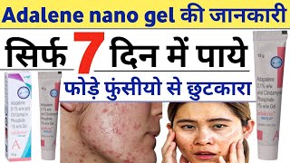 Adalene nano gel  adalene nano gel how to use  adalene nano gel uses in Hindi  adapalene review [upl. by Storz]