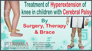 Cerebral Palsy Children with Hyperextension of Knee Treatment by Therapy Brace Surgery at Trishla [upl. by Dasha]