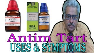 Anitim Tart  Uses amp Symptoms in Homeopathy by Dr PS Tiwari [upl. by Mauer766]