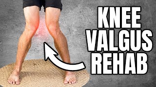 Knock Knees Correction Knee Valgus Exercises [upl. by Alexandros698]