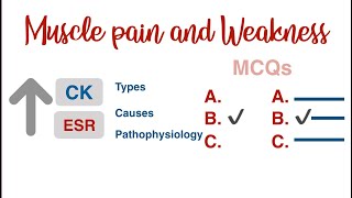 Myopathies Polymyalgia rheumatica Fibromyalgia Dermatomyositis Polymyositis amp more  USMLE MCQs [upl. by Nytsyrk783]