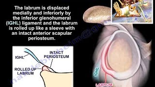 Lesions Of The Shoulder ALPSA lesion  Everything You Need To Know  Dr Nabil Ebraheim [upl. by Annekam45]