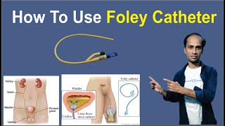 Foley Catheter  Foley Catheter and Drainage Bag Care  How Long To Use Foley Catheter [upl. by Monreal]