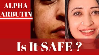 Is Alpha Arbutin Safe in Skin care and Body care Should you stop it After 3 months [upl. by Tatiana419]