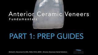 Anterior Ceramic Veneers Part 1 Preparation Guides [upl. by Wake]