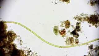 🔬 Mikroorganismus  microcosmos  funny microorganism in a puddle  life in a drop of water Full HD [upl. by Risteau]