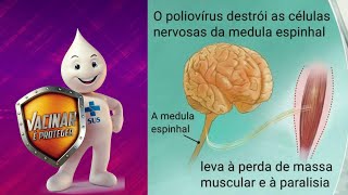 POLIOMIELITE  Conteúdo Completo  Sintomas Fatores de risco Diagnóstico Tratamento e Prevenção [upl. by Catarina962]