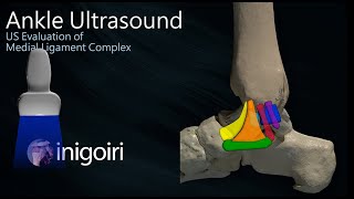 ANKLE US MEDIAL LIGAMENT COMPLEX EVALUATION [upl. by Jowett]