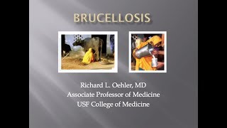 Brucellosis  Richard Oehler MD [upl. by Marie-Jeanne414]