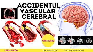 Accidentul vascular cerebral AVC Îngrijirea pacientului cu AVC [upl. by Ahsiuqat]