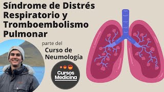 Síndrome de Distrés Respiratorio y Tromboembolismo Pulmonar [upl. by Notsirk]