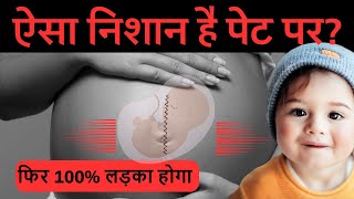 पेट पर ये निशान हो तो लड़का होने की निशानी है  Signs of a Baby Boy Based on Belly Marks [upl. by Freeland]