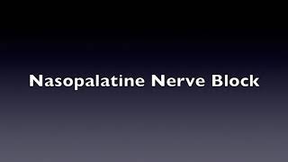 Nasopalatine Nerve Block [upl. by Norval995]