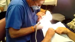 Dentist Drilling My Tooth [upl. by Tips]