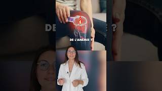 L’anémie inflammatoire 🔥 conséquence de l’inflammation chronique [upl. by Sigismundo884]