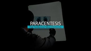 Paracentesis for Peritoneal Mesothelioma  Mesothelioma Hope [upl. by Neelcaj]